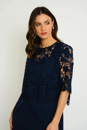 Carraig Donn 25Ss Detachable Lace Top Dress