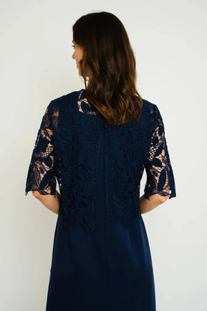 Carraig Donn 25Ss Detachable Lace Top Dress